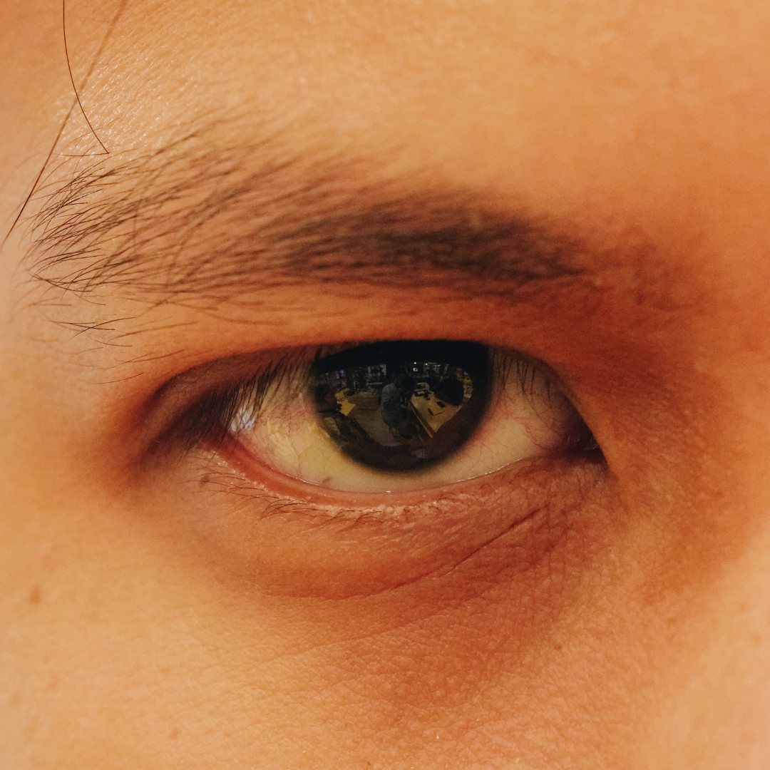 6-Gejala-Nistagmus-yang-Harus-Kamu-Waspadai.png